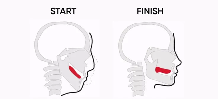 Demonstration of proper tongue posture for mewing technique